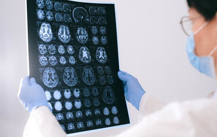 doctor examining results of a MRI scan of patient’s brain