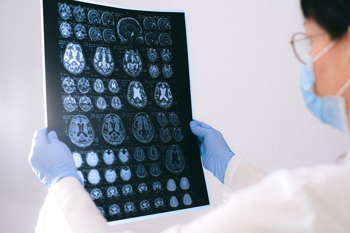 doctor examining results of a MRI scan of patient’s brain